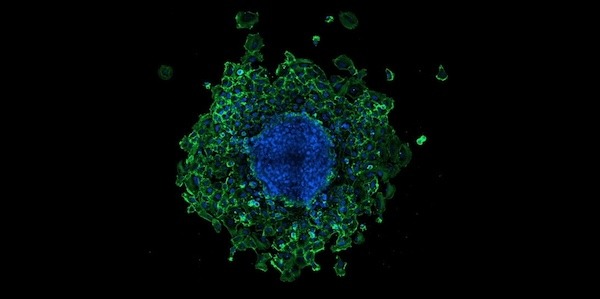 BioTek TekTalk: Ensayos de migración celular in vitro